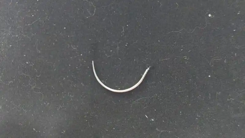 Легкие, как швейная машина: казахстанец вытащил иглу из своей судьбы