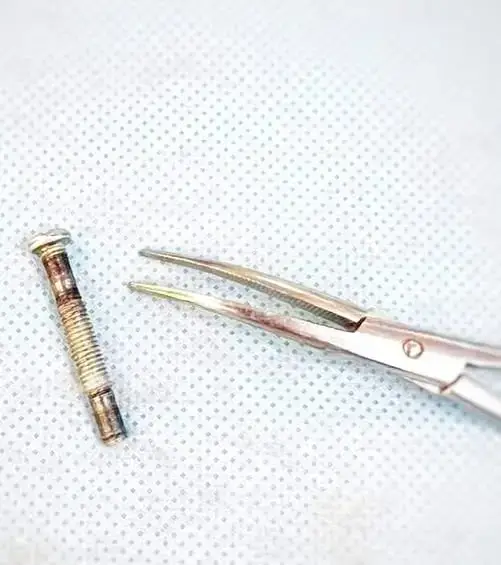 Международные врачи Туркестанской областной детской больницы успешно провели операцию по извлечению болта из горлянки 1-летнего ребенка Астане