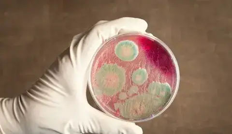 Ситуация с сибирской язвой в Байсерке: местные власти подтверждают отсутствие угрозы для жителей Астане