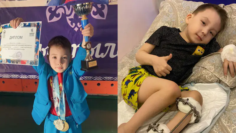 В 2022 году история маленького Алмаза, который сражается за жизнь, тронула тысячи людей. Несмотря на мрачные прогнозы врачей, ребёнок с невероятной силой духа доказал, что способен преодолеть все трудности. Астане