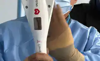 Восстановление функций митрального клапана у пациента с высоким хирургическим риском в НИИКВБ