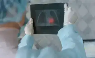 Туберкулёз в университетских стенах: тревожный звоночек для студентов Астаны и Алматы