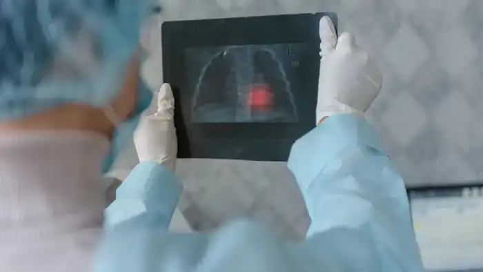 Туберкулёз в университетских стенах: тревожный звоночек для студентов Астаны и Алматы Астане