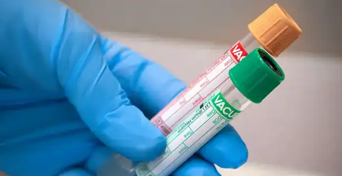 Международная борьба с монополизмом: восстановление конкурентоспособности в лабораторных услугах в 16 городах Астане