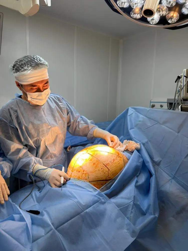 25 килограммов здоровья: гигантская опухоль удалена! Астане