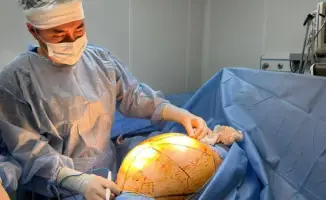 25 килограммов здоровья: гигантская опухоль удалена!