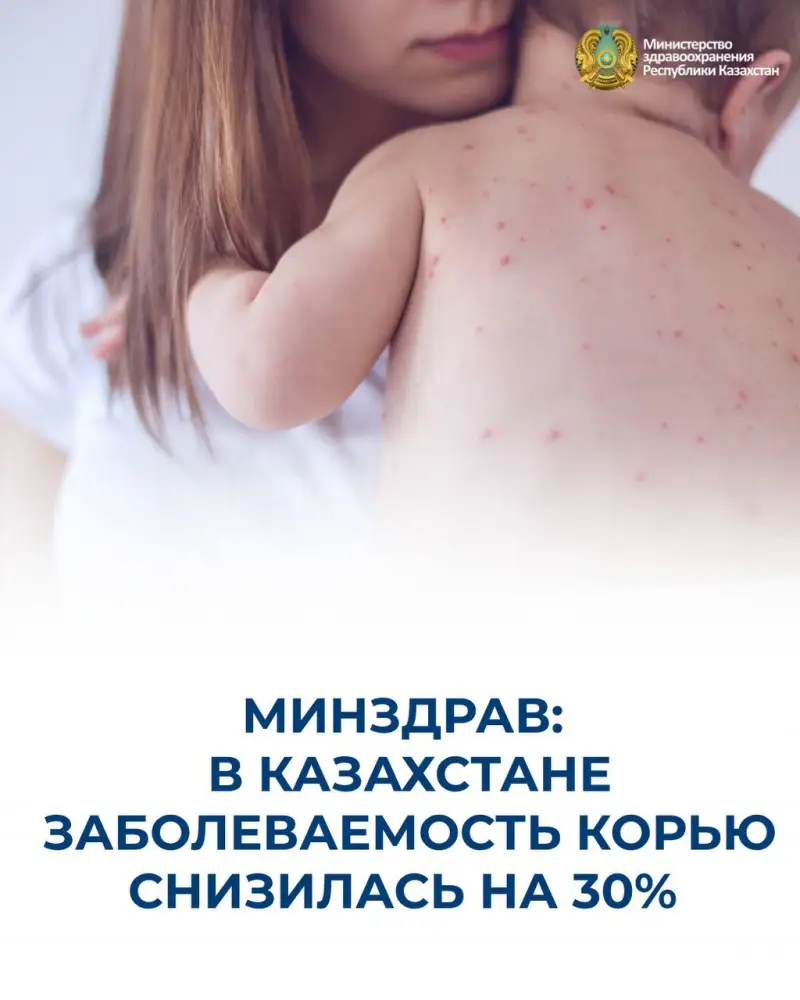 Эффективность вакцинации: снижение случаев кори в Казахстане на 30% Астане