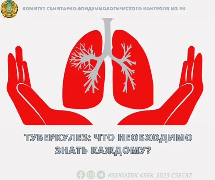 Туберкулез: влияние инфекции на общественное здоровье и меры профилактики Астане